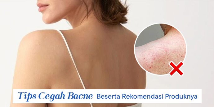 5 Kebiasaan yang Perlu Dilakukan Supaya Nggak Bacne Beserta Rekomendasi Produk